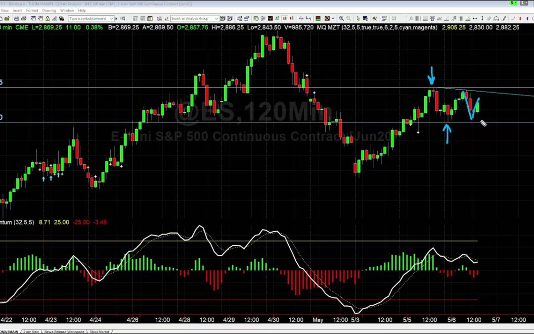 Mistakes Traders Make: Identifying Compression